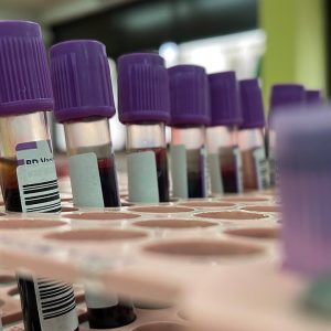 Monkeypox vaccine plans lead to stock jump for biopharma company